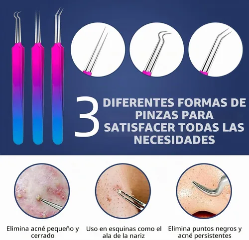 Vista 2 de Kit de herramientas para reventar espinillas – Kit de 10 piezas de extractor de espinillas con funda de metal para una eliminación rápida y fácil