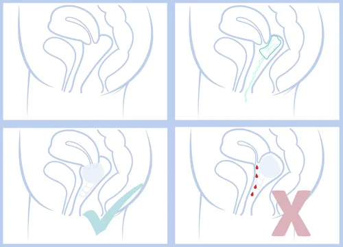 Vista 4 de Merula Copa menstrual Copa menstrual hecha de silicona de grado médico