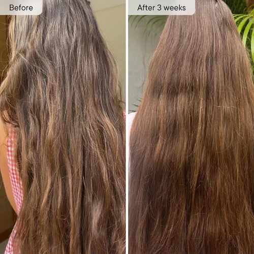 Vista 2 de Qure Cabezal de filtro de ducha para agua dura, cabello, piel y uñas más saludables, reduce el 99% de cloro, cabezal de ducha de alta presión