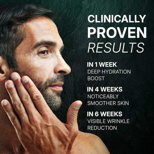 Vista 5 de ABERA Suero de retinol para hombre, suero antienvejecimiento para la cara, reduce las manchas oscuras, melasma, arrugas y bolsas para los ojos