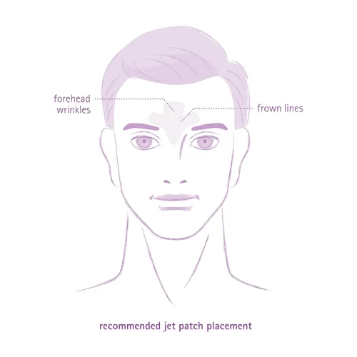 Vista 5 de Toute Nuit - Parches antiarrugas – Jet – Cinta facial para frente y líneas grandes fruncidas – Parches hipoalergénicos antiarrugas – 20