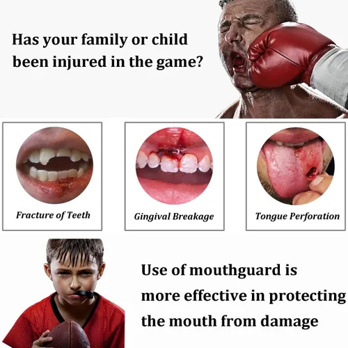 Vista 3 de Protectores bucales juveniles de fútbol para niños, para deportes, boquilla, boxeo, protectores bucales para artes marciales mixtas y rugby
