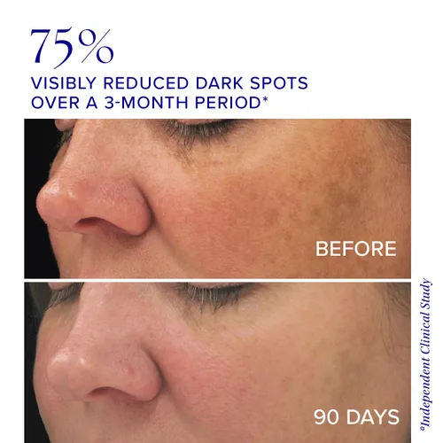 Vista 3 de iS CLINICAL Complejo iluminador, complejo iluminador de la piel, aborda las manchas de la edad