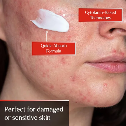 Vista 6 de PyratineXR Crème - Tratamiento antienvejecimiento y rosácea - Ultimate Cytokinin Skin Cream Reduce el enrojecimiento facial, lesiones de acné