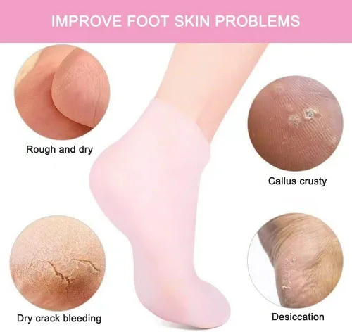 Vista 4 de 2 pares de calcetines hidratantes suaves de silicona, calcetines hidratantes para piel seca y dura agrietada, calcetines de gel de spa hidratantes
