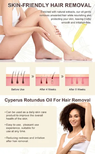 Vista 2 de Aceite Cyperus Rotundus, 100% puro y natural Cyprus Rotundus aceite para depilación y reducción del crecimiento del vello corporal (1 unidad)