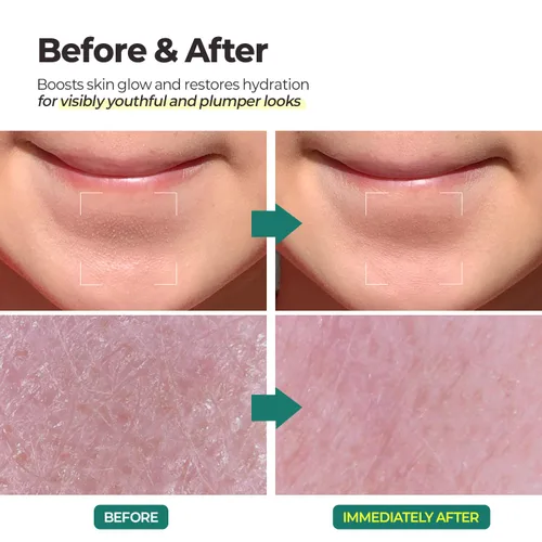 Vista 4 de MOTHER MADE Gel exfoliante facial vegano con té verde, vitamina E, ácido hialurónico, 3.38 onzas líquidas. Exfoliante facial suave y natural