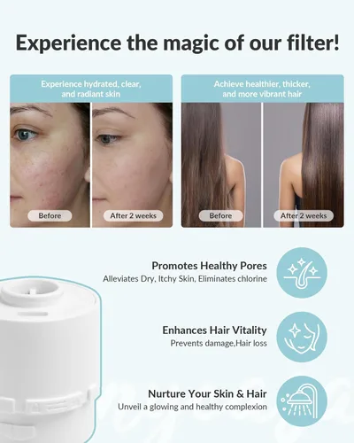 Vista 2 de SANYCASA Filtro de ducha para cabezal de ducha de belleza SANYCASA, filtro KDF-55 recomendado por dermatólogos para suavizar el agua dura, mejora