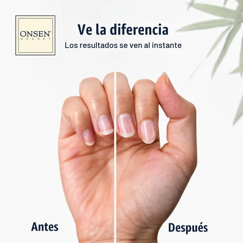 Vista 7 de Onsen Secret Kit completo de reinicio de uñas con aceite de cutícula de 0.3 fl oz, lima de uñas de grano 120/180 de doble cara, un bloque