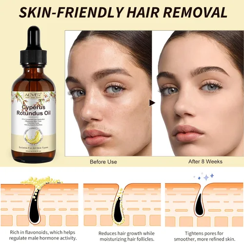 Vista 3 de Cyperus Rotundus - Aceite para depilación, 2 unidades 100% puro y natural para depilación corporal y facial para mujeres, reduce el crecimiento