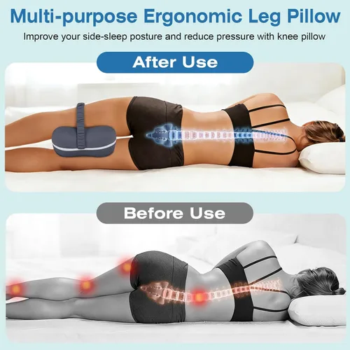 Vista 5 de SereneCloud Knee Pillow for Side Sleepers, Memory Foam Knee Pillow, Leg Pillows for Sciatica, Back, Hip, Knee & Ankle Pain Relief