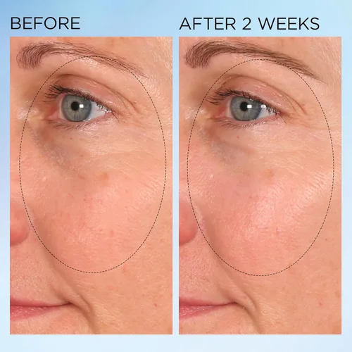 Vista 6 de Elizabeth Arden Cápsulas nocturnas de corrección de manchas claramente radiantes que iluminan visiblemente