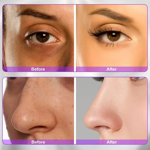 Vista 8 de Dispositivo de alta frecuencia portátil de alta frecuencia Varita Electrodo Beauty Parts ETJX006BC (punto púrpura)