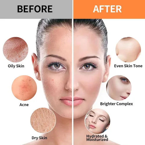 Vista 4 de Mascarilla facial de gelatina de árbol de té de 24 quilates para tratamientos faciales, hidratante, antienvejecimiento y nutritiva, máscaras