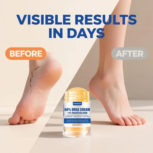 Vista 4 de Crema de Urea Stick 60% más Ácido Salicílico 2%, Crema de Pies de Urea de Fuerza Máxima para Talones Secos y Agrietados, Removedor de Callos