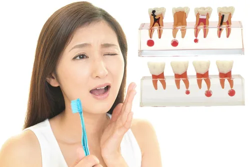 Vista 9 de Modelo de tratamiento endodóntico Dentalmall, de cuatro etapas, para enseñar a estudiantes, modelo 4018
