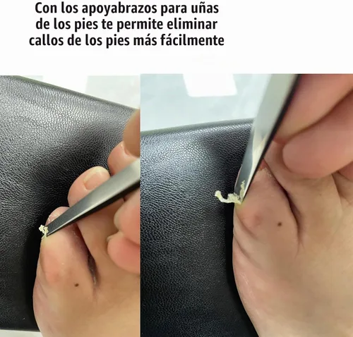 Vista 2 de Cuchillo de pedicura, herramientas para uñas encarnadas, reposabrazos inclinado para uñas, utilizado para removedor de cutículas de uñas, callo