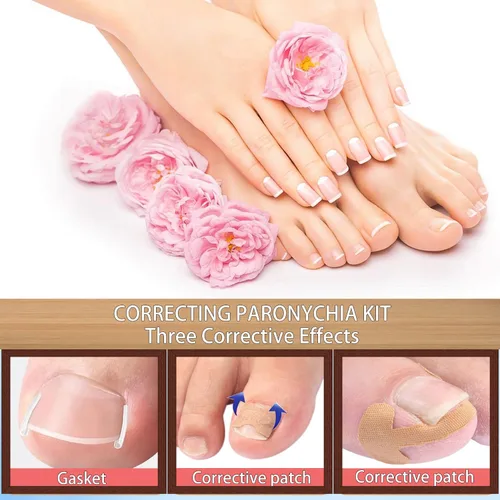 Vista 5 de Corrector profesional de uñas encarnadas para un alivio rápido con tiras transpirables de uñas encarnadas, herramientas de pedicura de acero