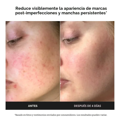 Vista 3 de Paula's Choice BOOST Crema Gel Potenciadora de Ácido Azelaico al 10% Suero Facial con Ácido Salicílico, Suero Iluminador de Piel Sin Aceite