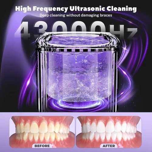 Vista 2 de Limpiador ultrasónico UV para dentaduras, limpiador ultrasónico de esterilización de 43 kHz para retenedor, protector bucal, alineador, frenos
