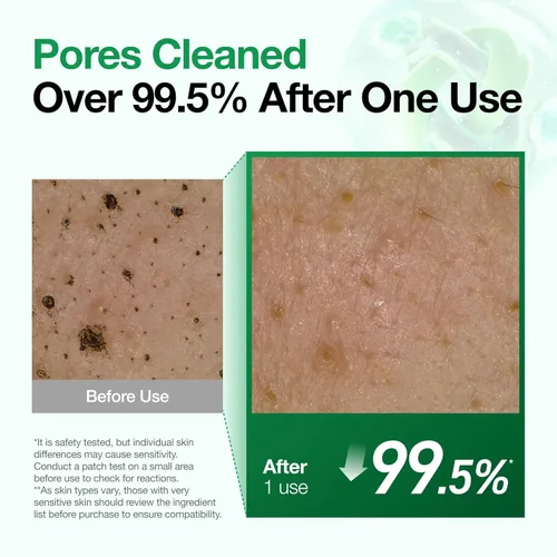 Vista 5 de Anua Heartleaf - Espuma limpiadora profunda de poros de quercetinol, lavado facial para limpiador de refinación de poros, limpiador facial diario