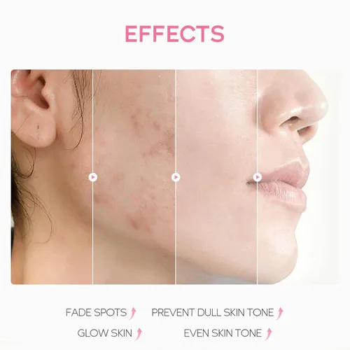 Vista 5 de Exfoliante de gel exfoliante naranja, exfoliante hidratante de limpieza profunda con enzimas, gel exfoliante purificante para cara y cuerpo