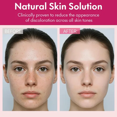 Vista 5 de Arbutin 7% + ácido tranexámico 4% crema facial para manchas oscuras y tono de piel desigual - Hidratante, no irritante, segura para pieles