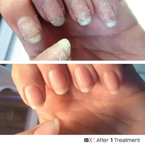 Vista 4 de Esmalte de uñas NUEVO! Mini paquete Duo con aceite Dadi gratis restauración de uñas protectoras
