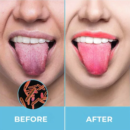 Vista 7 de HOKIN Raspador de lengua para adultos con estuche de viaje (paquete de 1 unidad de cuidado bucal) – Limpiador de lengua en forma de cuchara 100%