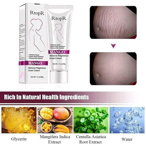 Vista 2 de RtopR Mango Crema para estrías y cicatrices - Crema para estrías y eliminación de cicatrices para el embarazo, la mejor crema hidratante corporal