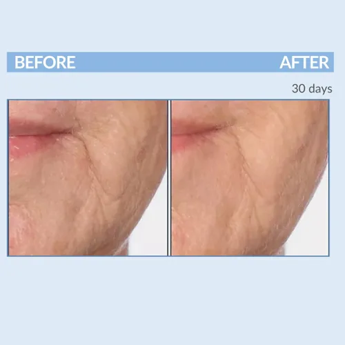 Vista 4 de Serious Skincare Vitamin A Force XR Retinol suero concentrado facial, micro exfoliante y rejuvenecimiento para piel radiante, para líneas, arrugas