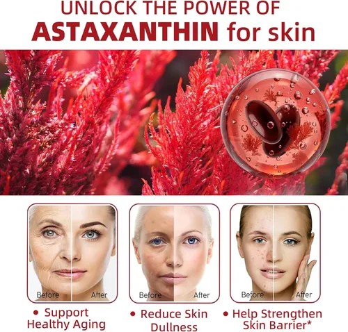 Vista 3 de Astaxantina 24 mg, suplementos antioxidantes de astaxantina premium con aceite MCT, Ashwagandha, apoya los ojos, la piel, inmune, circulación