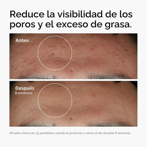 Vista 2 de The Ordinary Niacinamide 10% + Zinc 1%, Smoothing Serum for Blemish-Prone Skin