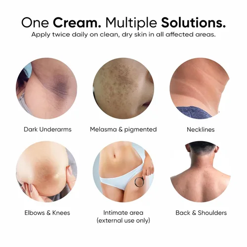 Vista 3 de Masofta Crema facial y corporal 2% de ácido kójico para pigmentación, melasma, marcas de acné, axilas, cuello, para hombres y mujeres, 1.0 fl oz