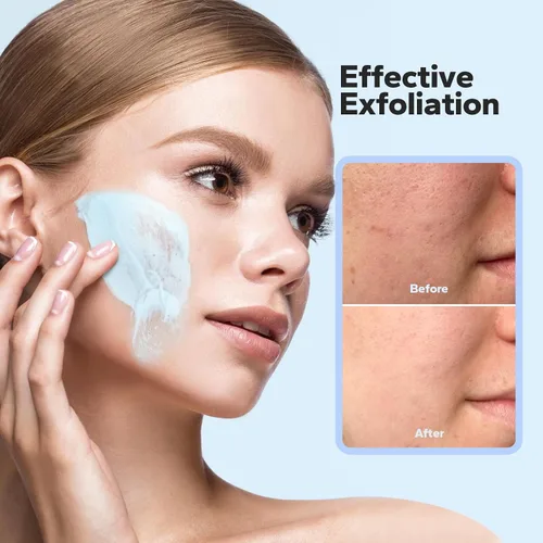 Vista 2 de SilkySecret Exfoliante facial (4.23 onzas), exfoliante facial, exfoliante facial de microdermoabrasión con piedra pómez natural, péptidos