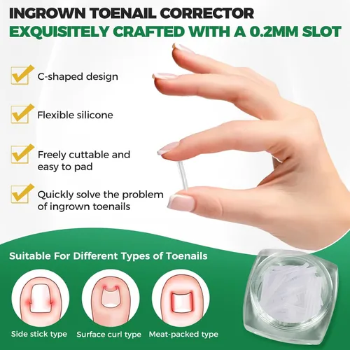 Vista 3 de Kit de eliminación de uñas encarnadas, tiras alisadoras de uñas sin dolor, 60 piezas, levantador de uñas y tijeras pequeñas, juego de corrector