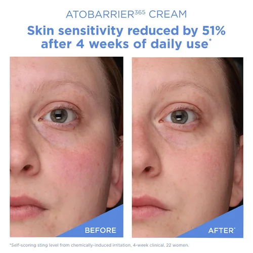 Vista 6 de AESTURA ATOBARRIER365 Crema con Ceramidas, Hidratante Facial Coreano para Reparación de la Barrera Hidratación Duradera de 120H, Cápsulas