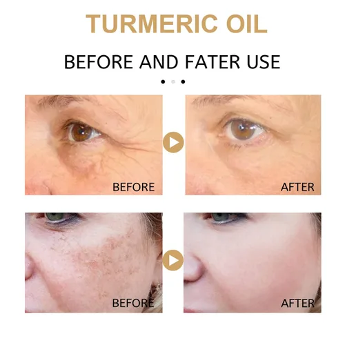 Vista 7 de Paquete de 2 sueros correctores de manchas oscuras con cúrcuma, suero facial reparador, cúrcuma natural para cuidado de piel brillante, sueros