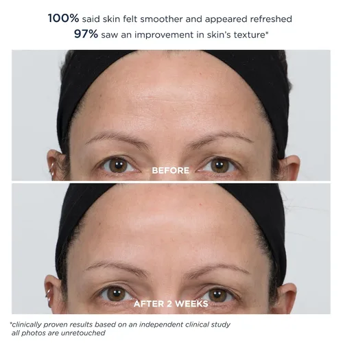 Vista 8 de M-61 PowerGlow® Peel Extra Strength 20%