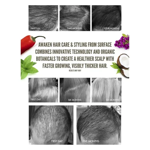 Vista 4 de Surface Acondicionador terapéutico Hair Awaken
