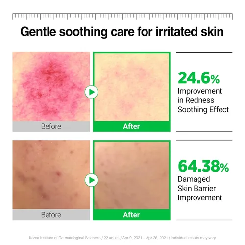 Vista 4 de WELLAGE Crema calmante Cica - Hidratante calmante facial coreano, madecassoside de alta pureza con pantenol de centella asiática, calma la piel