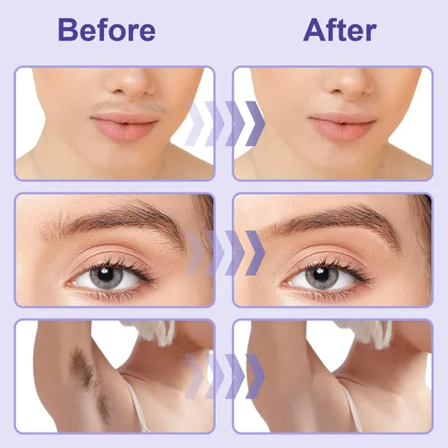 Vista 3 de Kit de cera facial, kit de depilación para microondas para mujeres