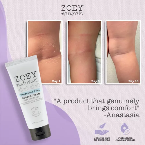 Vista 4 de Crema para pañales para bebés, aprobada por pediatras y dermatólogos, óxido de zinc y arcilla de caolín para alivio calmante y curación, ganadora