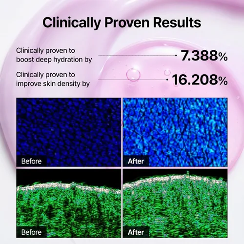 Vista 8 de Dr.Melaxin Crema facial de unión de calcio con REBORNIC 10,000 ppm y EGF, hidratante facial antienvejecimiento para densidad de piel, ceramida