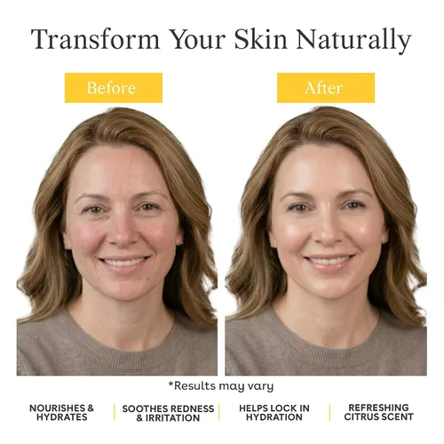 Vista 5 de Suki Skincare Barra limpiadora de piel sensible, 4 onzas