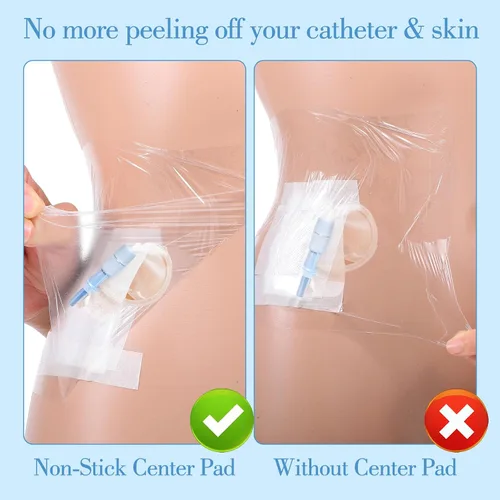 Vista 5 de 40 fundas de ducha de ostomía impermeables, protectores de catéter de diálisis para estoma de ducha, cubiertas de catéter de gran cobertura, vendaje