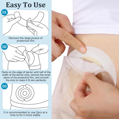 Vista 5 de 40pcs Skin Barrier Strip Elastic Ostomy Barrier Tape Waterproof Hydrocolloid Extenders Pressure Sensitive Sticker ostomy Supplies colostomy Supplies