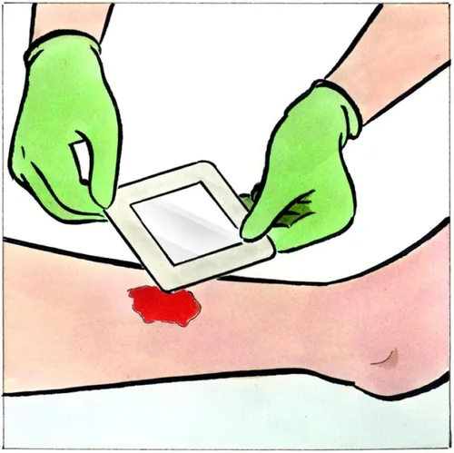 Vista 6 de Medline Stratasorb - Apósitos adhesivos impermeables para heridas, 4 x 4 pulgadas, caja de 10