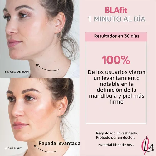 Vista 2 de Dispositivo de relleno de labios Dispositivo de relleno de labios no invasivo, sin dolor, ejercicio diario de 60 segundos para labios más llenos