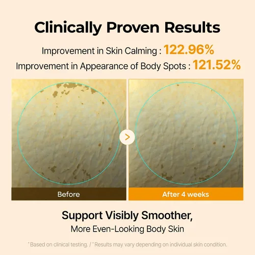 Vista 3 de Dr.Melaxin Crema corporal de cúrcuma de ácido kójico con ceramidas, hidratante corporal iluminador para manchas oscuras y tonos desiguales, pantenol